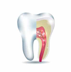 3 things about root canals you might not know