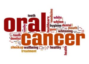 Why It’s Important to Get Regular Oral Cancer Screenings