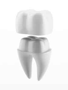 dentalcrownwhite