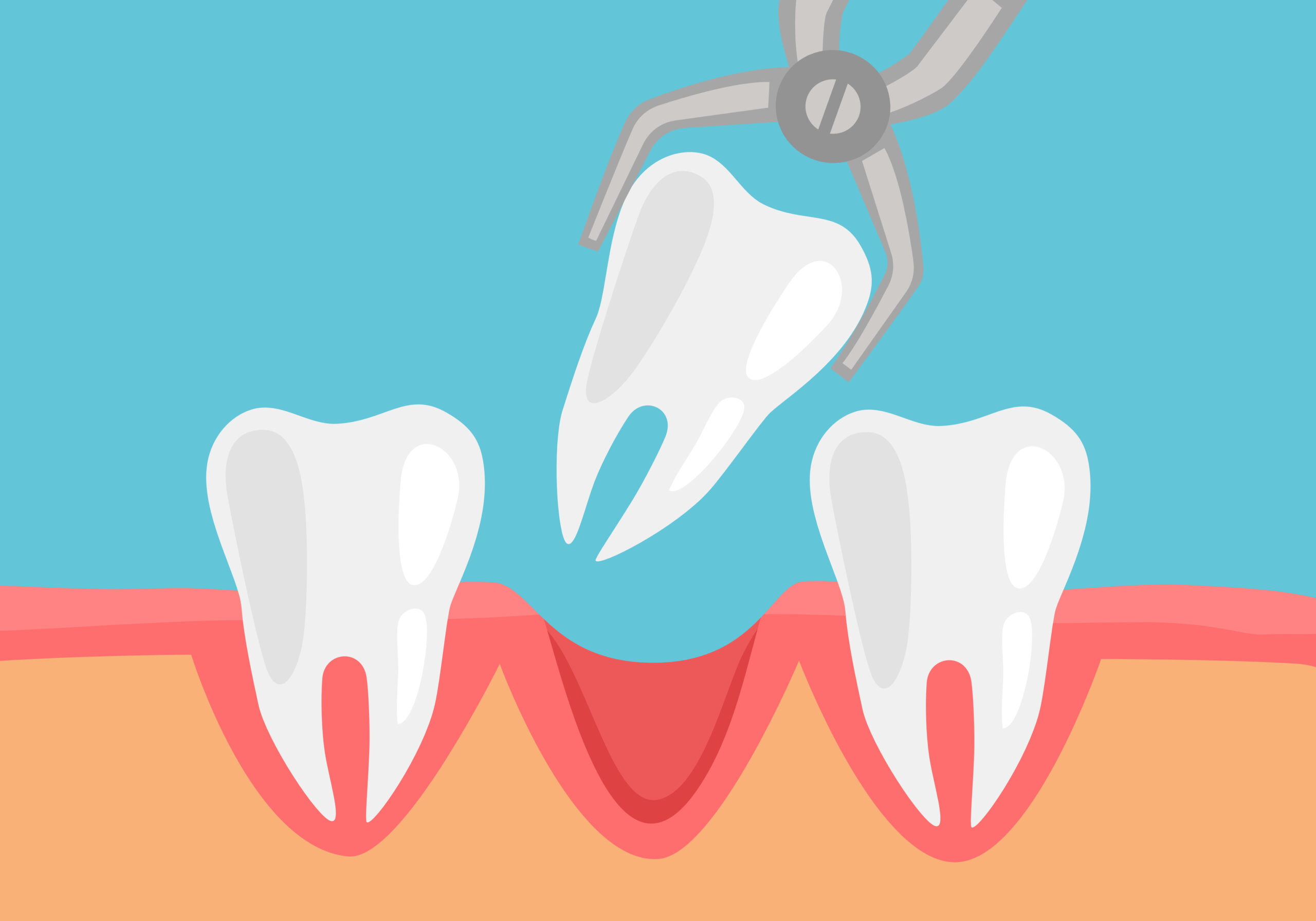 can-an-infected-tooth-cause-a-sore-throat-dental-health-society