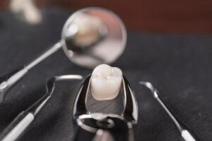 prairie village tooth extraction