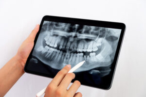 prairie village digital x-rays