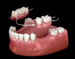 prairie village partial denture