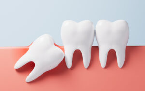 prairie village tooth extraction