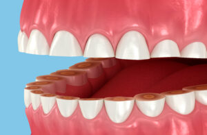 prairie village tmj and bruxism