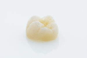 prairie village dental crowns