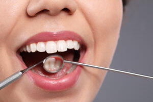 prairie village oral cancer screening