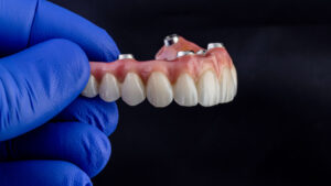 prairie village dental implant dentures