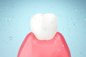 prairie village ultrasonic scaling