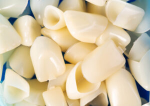 prairie village crowns