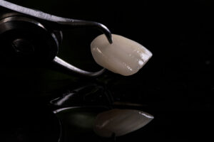 prairie village veneers