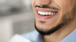 prairie village gum contouring