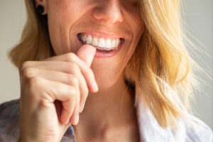 prairie village clear aligners