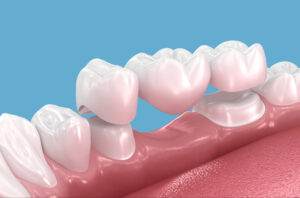 prairie village restorative dentistry
