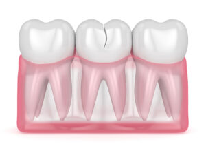 prairie village urgent care dentistry