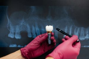 prairie village restorative dentistry