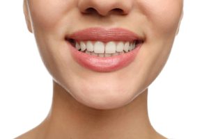 prairie village teeth whitening